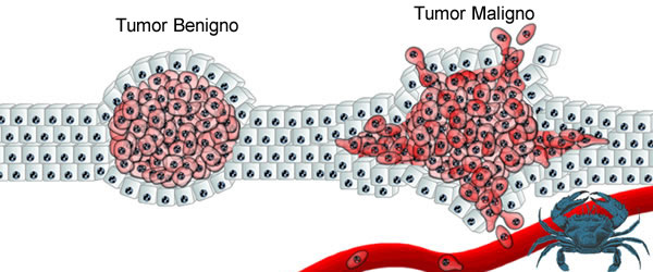 Fig8: Tipos de tumores