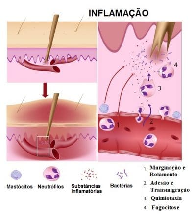 Fig.11: Reação inflamatória a uma farpa