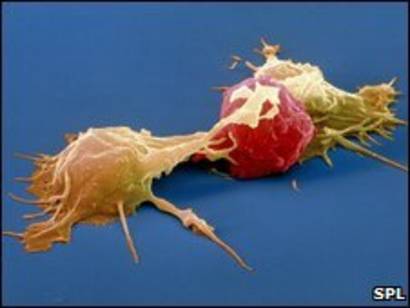 Fig.14: Duas células natural killers atacam uma célula cancerosa
